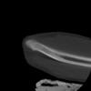 SPORK, NICO - 22.03.1976 - 02.08.2022 - CT obere Extremität - 17:59:38